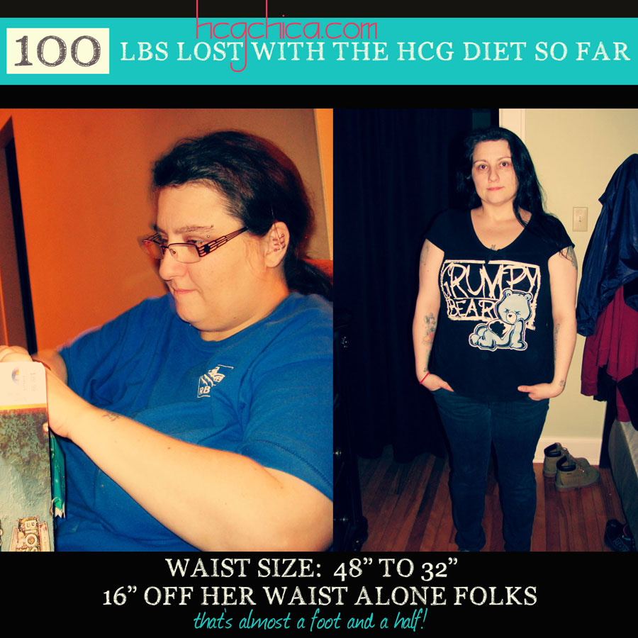 hCG Diet Interviews – Episode 7 – 100lbs lost with the HCG Diet