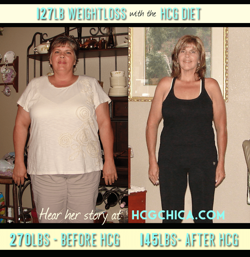 hCG Diet Reviews - 127lbs lost - maintained weight loss 1 year - Episode 6