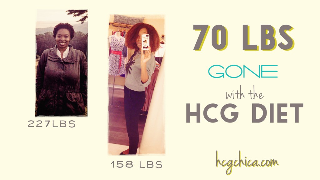 Before and After hCG Diet Results - Episode 12 - 70lb Weight Loss