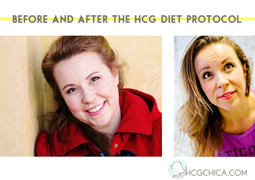 Before After hCG - Difference in Face - hcgchica.com