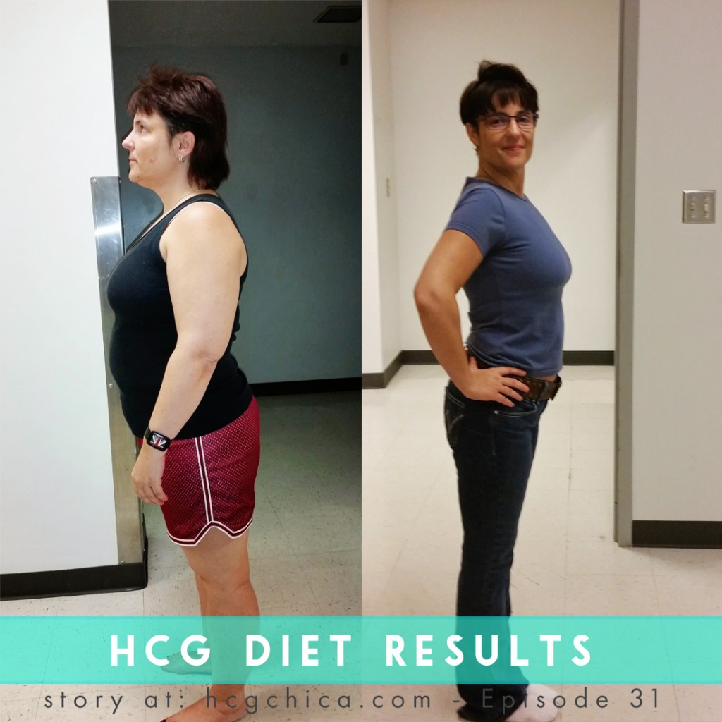 hcg-diet-results-episode-31-tracey (2)
