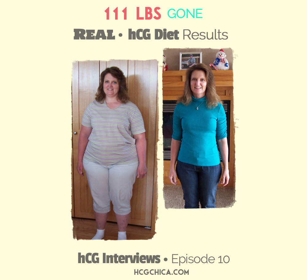 before-after-hcg-diet-111lbs-weight-loss-episode-10-web